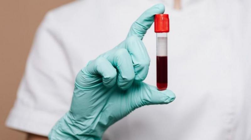 New Blood Group: 50 years old mystery related to blood group solved, scientists discovered rare blood group