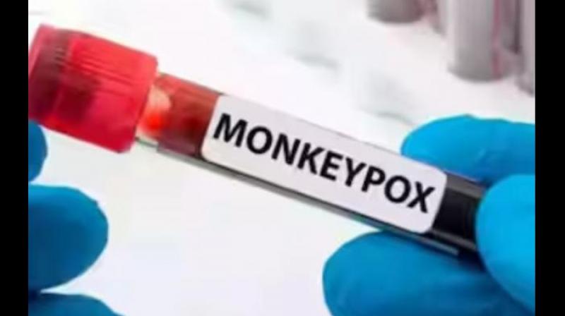 Monkeypox in India: Condition of monkeypox patient admitted in LNJP hospital is stable, Health Minister informed