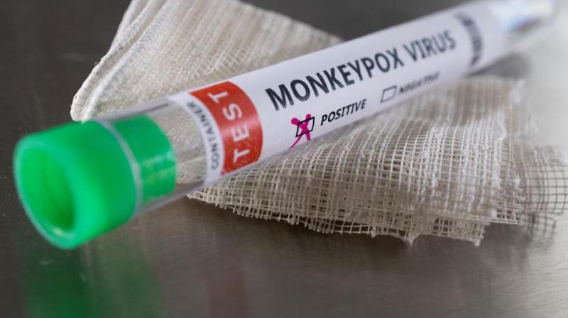 MonkeyPox Update: First indigenous kit made to test monkeypox News in hindi