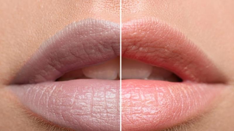 If you are troubled by the blackness of lips, then adopt these home remedies