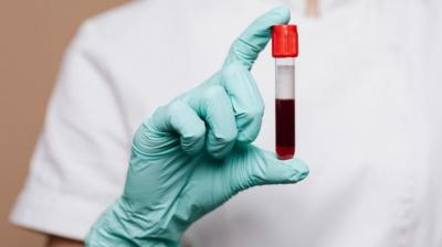 New Blood Group: 50 years old mystery related to blood group solved, scientists discovered rare blood group