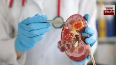 5 morning habits that can quietly harm your kidneys, according to experts news in hndi 