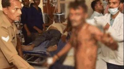 The young man set himself on fire near CM's residence